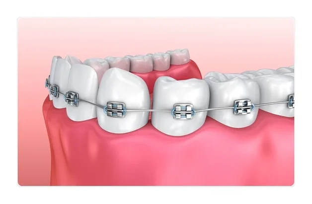 Dr M.M Pula_Polokwane Dentist_Braces & More logo